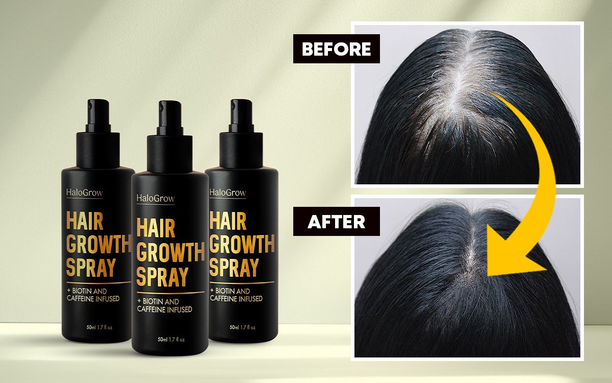 HaloGrow Hair Growth Spray with before and after results