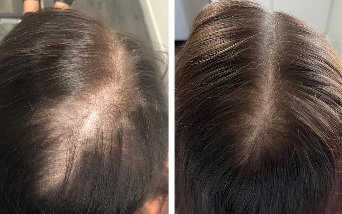 Week 8 - before and after comparison